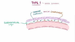 Analgesic Nephropathy AN Kidney Damage from NSAIDs [upl. by Burhans244]