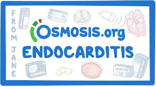 Clinicians Corner Endocarditis [upl. by Modesty]