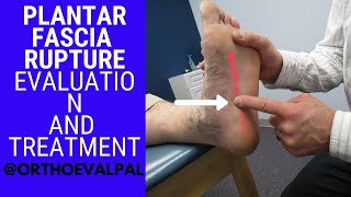 Plantar Fascia Rupture Evaluation with Paul Marquis PT [upl. by Kazim74]