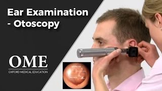 Otoscopy Ear Examination  ENT [upl. by Ahsercul]