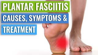 Plantar Fasciitis Causes Symptoms amp Treatment [upl. by Jesh]