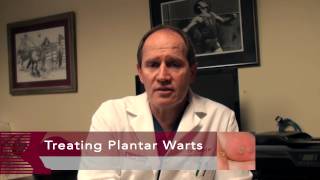 How to Get Rid of Plantar Warts [upl. by Ireg]