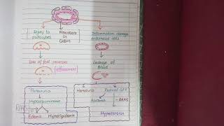 Lupus Nephritis Classifications Explained  NasirMed [upl. by Dhruv]