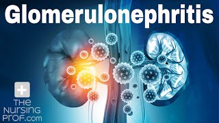 Renal Emergencies Glomerulonephritis [upl. by Alatea]