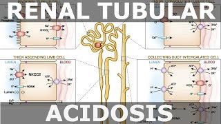 Renal Tubular Acidosis [upl. by Dawson]