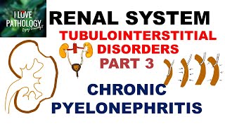 CHRONIC PYELONEPHRITIS  PATHOLOGY [upl. by Kahl7]