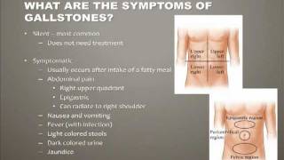 Fish Facts  Swim Bladder Function amp Buoyancy Disorders [upl. by Andras]