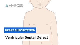 Ventricular Septal Defect VSD  Heart Auscultation  Episode 11 [upl. by Valiant]