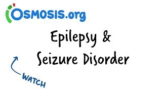 Epilepsy amp Seizure Disorder  Clinical Presentation [upl. by Nodnelg]