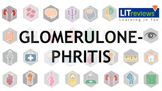 Glomerulonephritis [upl. by Varuag]