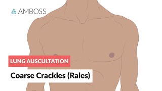 Coarse Crackles Rales  Lung Auscultation  Episode 3 [upl. by Chin]