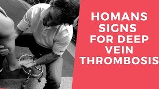 Homans Sign for Deep Vein Thrombosis [upl. by Onej]