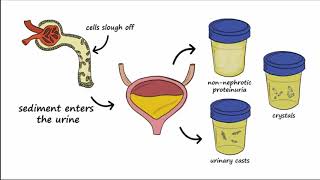 Menopause  an Osmosis Preview [upl. by Nissa]