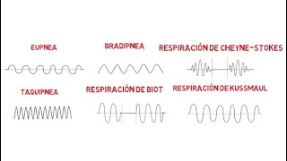 Patrones respiratorios Eupnea Bradipnea Taquipnea Biot CheyneStokes y Kussmaul [upl. by Itraa]