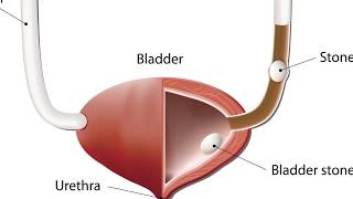 Gallbladder Symptoms and What To DO [upl. by Llerrac]