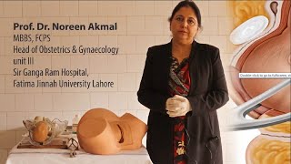 Prof Dr Noreen Akmal  Forceps Delivery Part 1 [upl. by Ldnek]